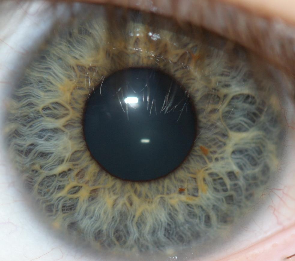 标题可见光下的人眼虹膜结构   图片来自维基百科 图片说明